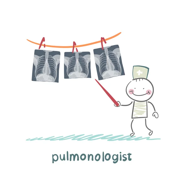 Pneumologista mostra uma radiografia de pulmão humano — Vetor de Stock