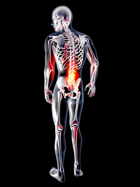 Анатомія - болі в спині — стокове фото