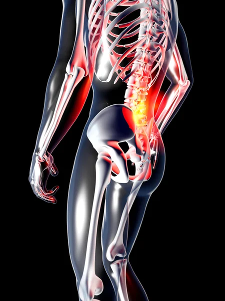 Анатомія - болі в спині — стокове фото