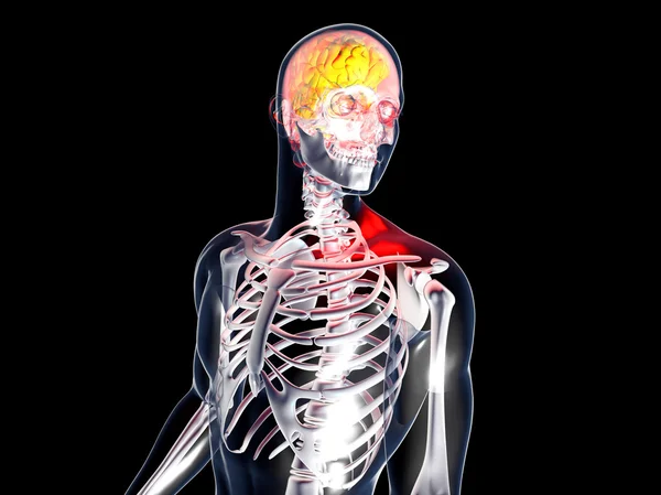 Anatomie - hoofdpijn — Stockfoto