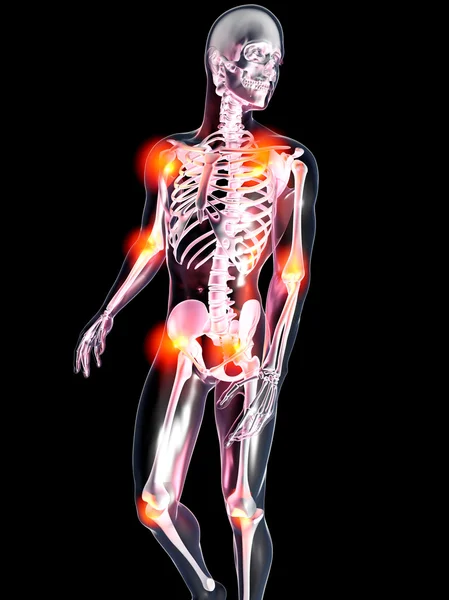 Anatomie - schmerzhafte Gelenke — Stockfoto