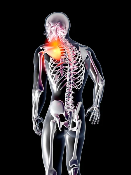 Анатомія - травмування плеча — стокове фото