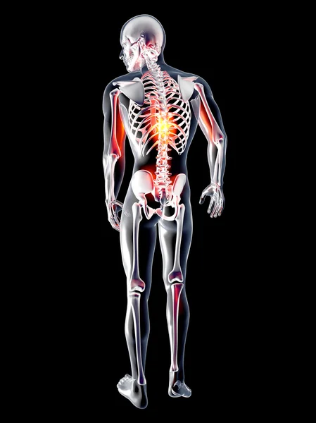 Anatomie - Rückenschmerzen — Stockfoto