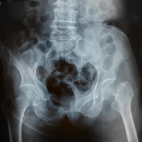 X-rays — Stock fotografie