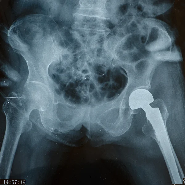 X-rays — Stock Photo, Image