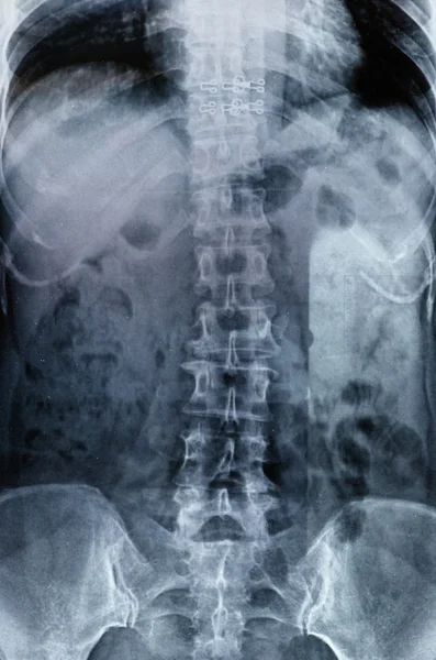 X-rays — Stock fotografie