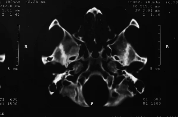 Röntgenstrålning — Stockfoto