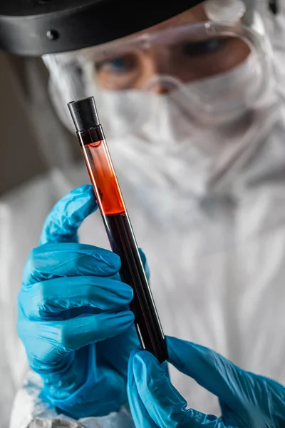 Trabalhadora Laboratório Feminina Detém Tubo Teste Sangue Para Testes — Fotografia de Stock