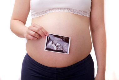 Ultrason fotoğrafçılık ile hamile kadın