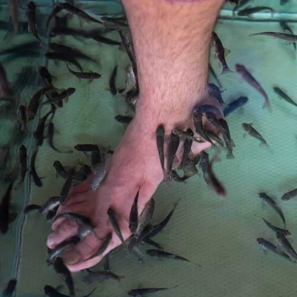 Gara Rufa Doctor Fish Treat Human Leg Skin Water Tank — 스톡 사진