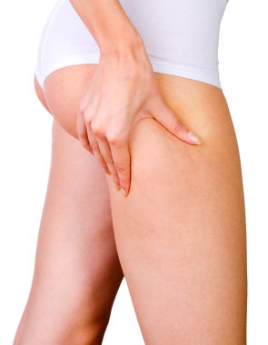 Selülit cilt kadın kalça at