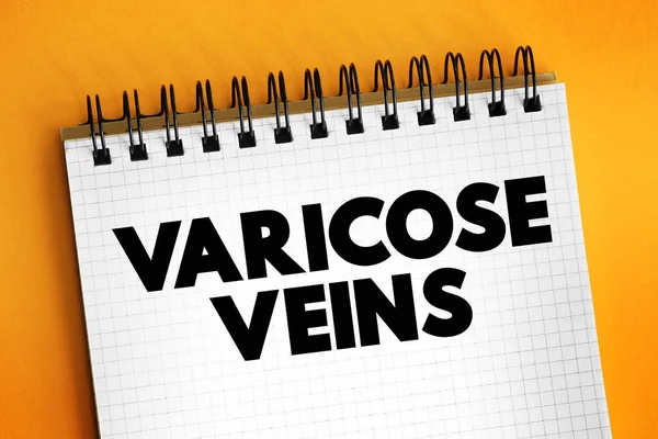 Varicose Veins இரத — ஸ்டாக் புகைப்படம்