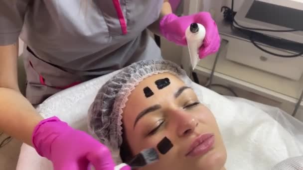 Carbon face peeling procedure. Laser pulseert de schone huid van het gezicht. Hardware cosmetologie behandeling. Proces van fotothermolyse, opwarmen van de huid, laser koolstofpeeling. Gezichtsverjonging. — Stockvideo