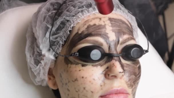 Esteticista aplica máscara negra en la cara de la mujer hermosa. hermosa mujer en el salón de spa haciendo procedimientos de peeling de carbono para la cara. — Vídeos de Stock
