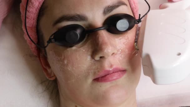 Femme souriante appréciant ELOS rajeunissement de la peau faciale. Femme avec gel rafraîchissant sur le visage et lunettes de protection laser, table de thérapie couchée à la clinique de beauté, traitement de la peau contre les imperfections, lifting. — Video