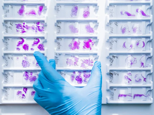 Hand in blue glove holding glass histology slides — Stock Photo, Image