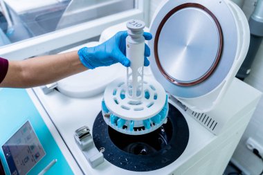 Laboratuvar asistanı modern laboratuvarda mikrodalga hibrit doku işlemcisi üzerinde çalışıyor..