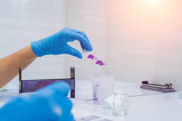 Hands in blue glove holding glass histology slides