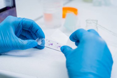 Mavi eldivenli eller cam histoloji slaytları tutuyor.