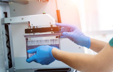 Laboratuvar asistanı modern laboratuvarda otomatik çoklu slayt boyayıcısıyla çalışıyor..