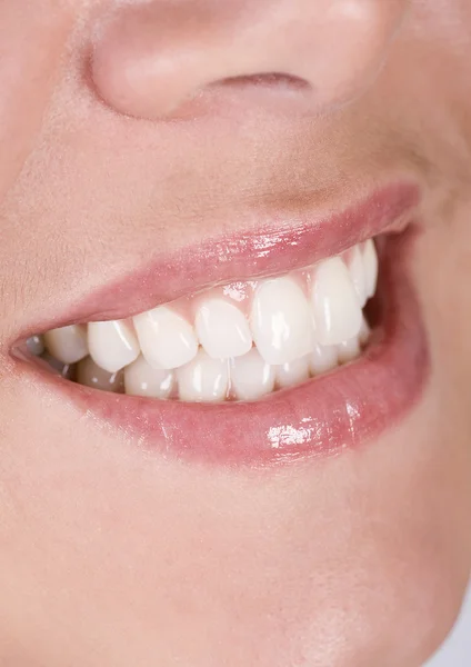 Dientes blancos — Foto de Stock