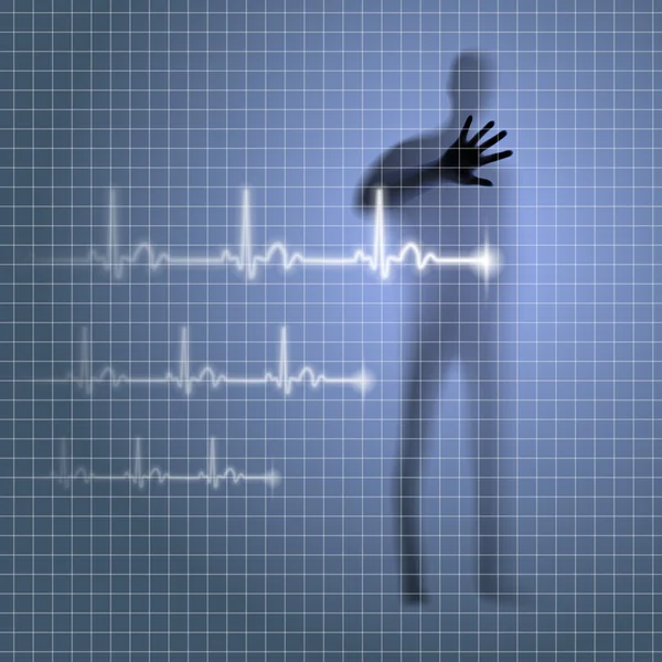 Heartbeat — стоковий вектор