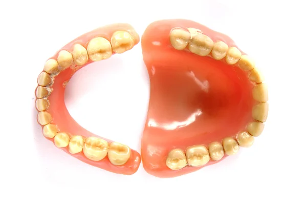 Prothèses dentaires isolées — Photo
