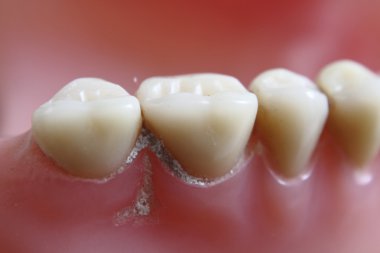 teeth problem clipart