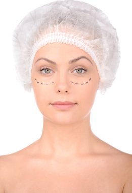 Anaplasty