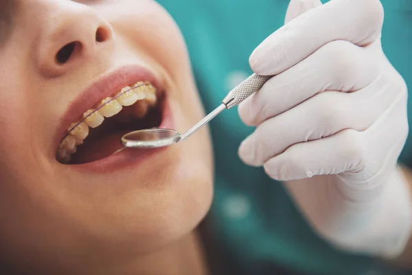 歯科医は 患者さんの歯を調べます クローズ アップ — ストック写真
