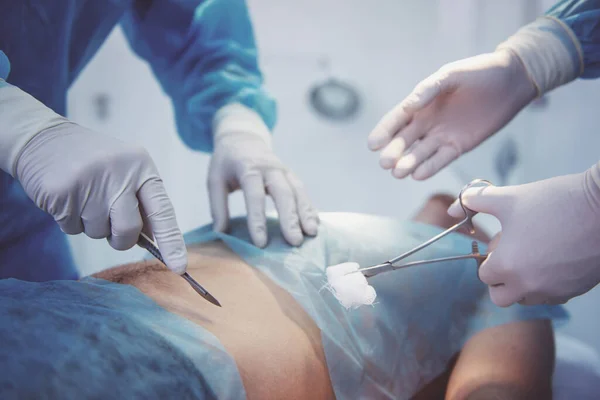 Zespół Chirurgów Jest Wykonanie Operacji Przy Użyciu Instrumentów Medycznych Nowoczesnej — Zdjęcie stockowe