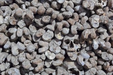 Kemik dokusunda insan kafatasları