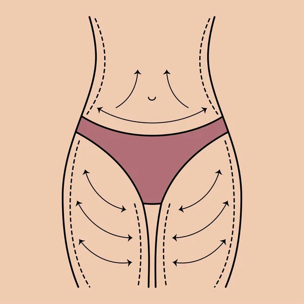 Correzione della massa corporea femminile — Vettoriale Stock