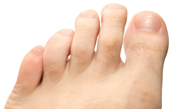 Men's toes on a white background — Stock Photo, Image