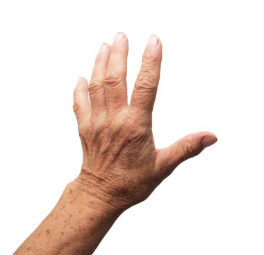 Arkaplan