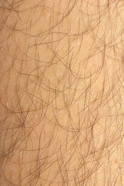 Background of the skin with hair. macro — Stock Photo, Image