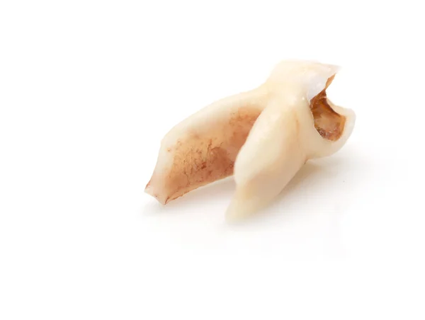 Tooth — Stock Photo, Image