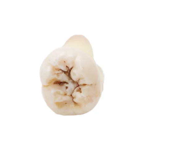 Tooth — Stock Photo, Image