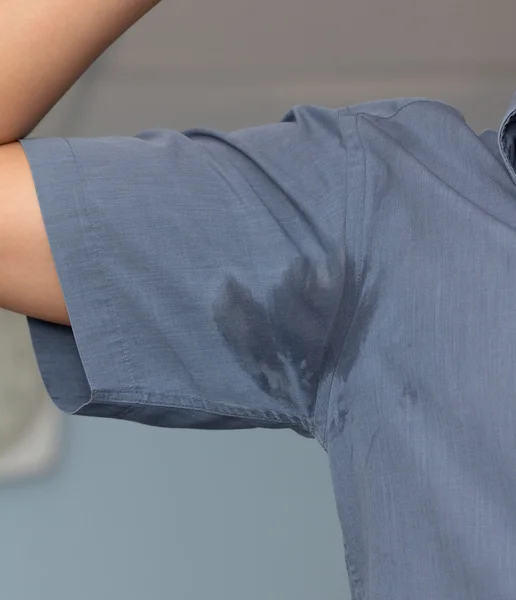 Man with hyperhidrosis sweating very badly under armpit in blue shirt — Stock Photo, Image