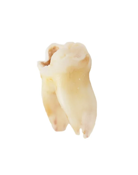 Tooth — Stock Photo, Image