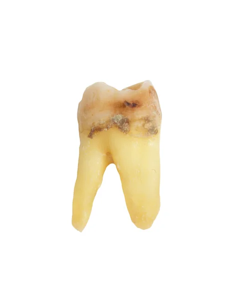 Dente — Fotografia de Stock