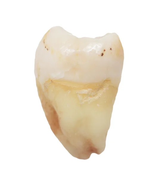 Зуб на белом фоне — стоковое фото