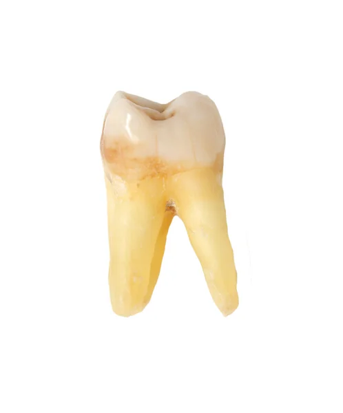 Zahn auf weißem Hintergrund — Stockfoto