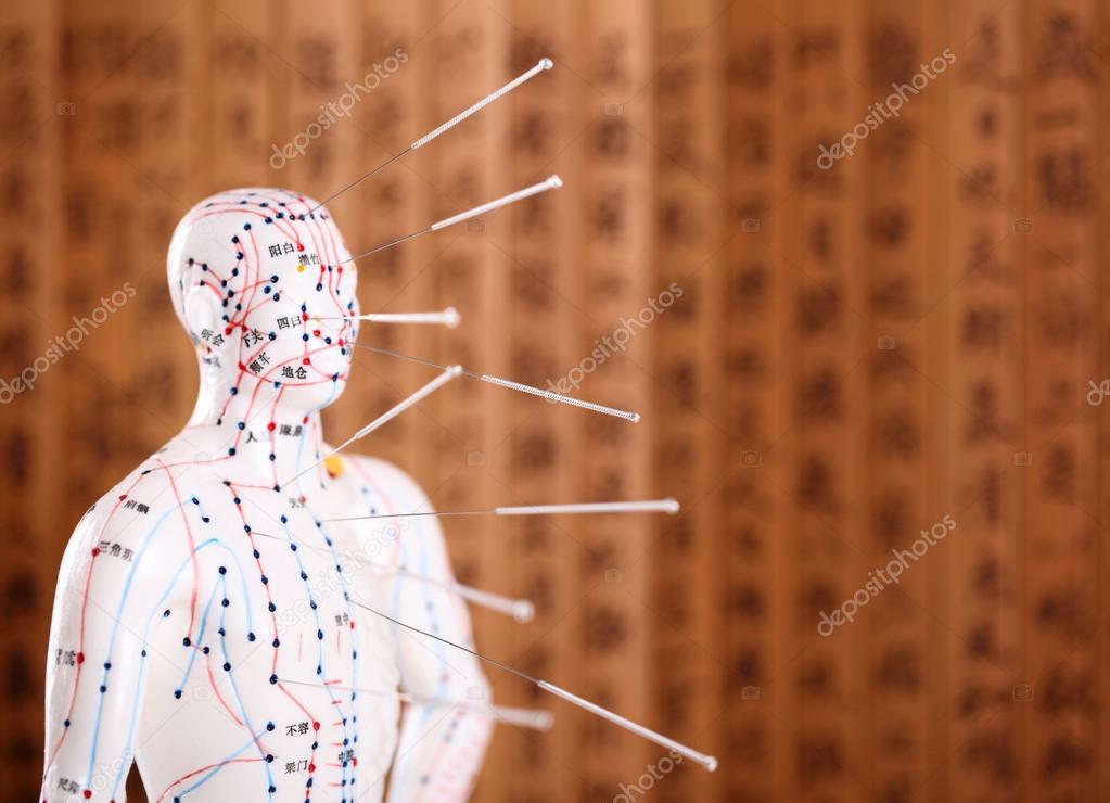 Eastern or Asian acupuncture Medical Treatment. — Stock Photo