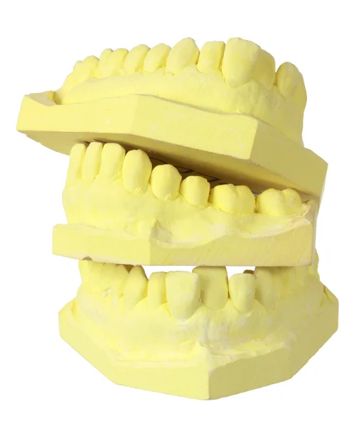 Formy zębów dentystycznych Zdjęcie Stockowe