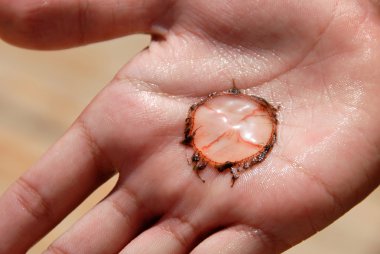 palm üzerinde denizanası