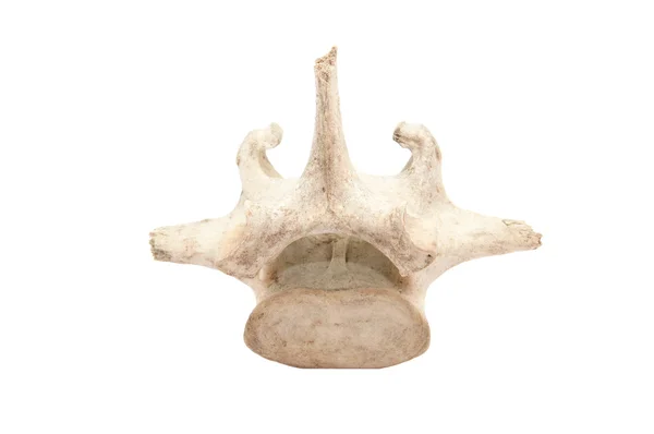 Vertebra — Stock Photo, Image