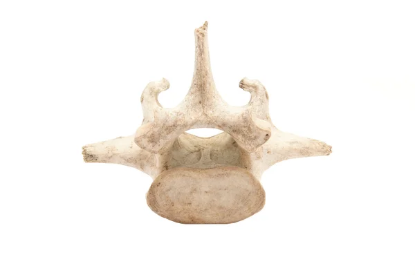 Vertebra — Stock Photo, Image