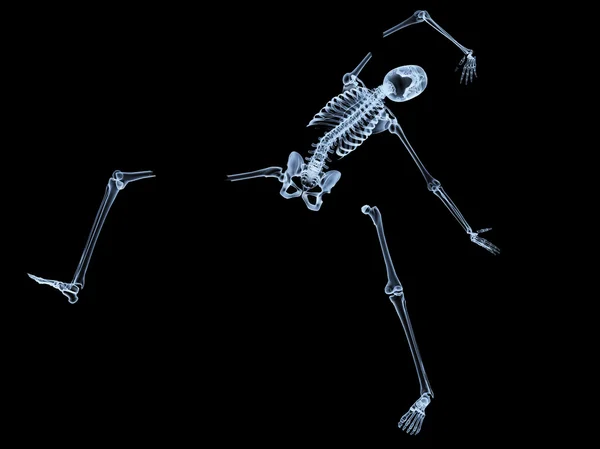 Shattered Skeleton — Stock Photo, Image