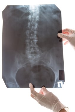 omurga x-ray görüntüsü üzerinde beyaz